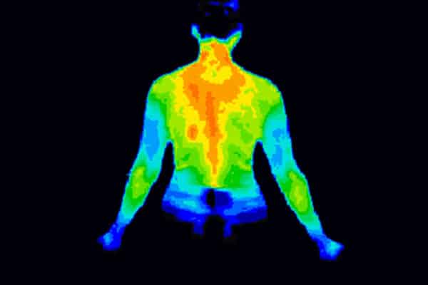 Thermographic,Image,Of,The,Back,Of,The,Upper,Body,Showing